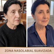 Nuvezza SedaLift™ | Sérum Reafirmante Coreano con Péptidos