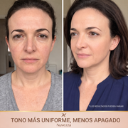 Nuvezza SedaLift™ | Sérum Reafirmante Coreano con Péptidos